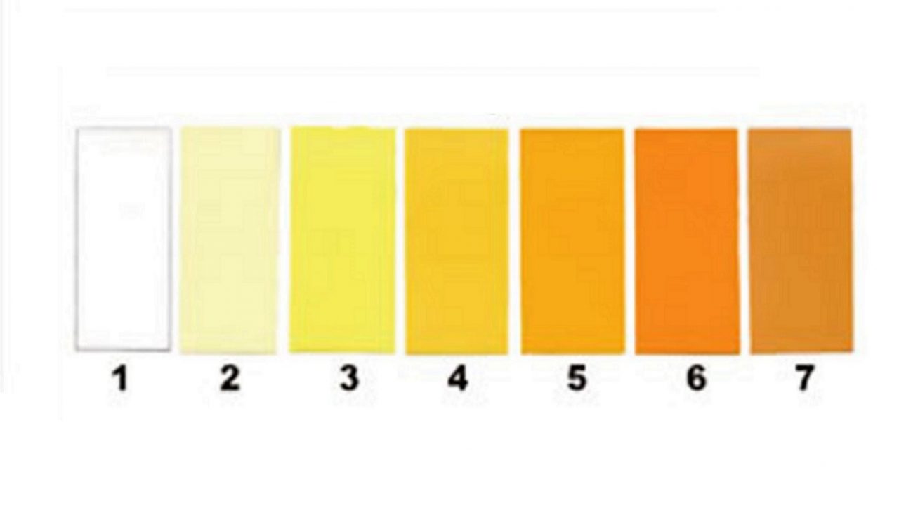 Culoarea urinei – ce spune despre starea ta de sănătate?