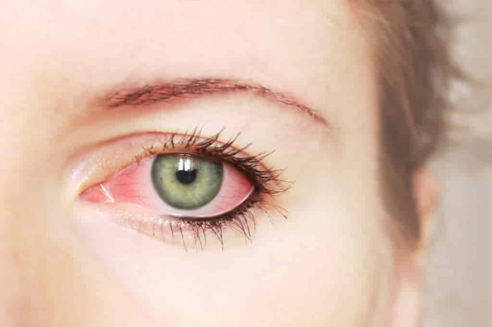 vitamine pentru deficiențe de vedere miopie câte dioptrii